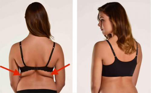 How to Get Rid of Lower Back Fat